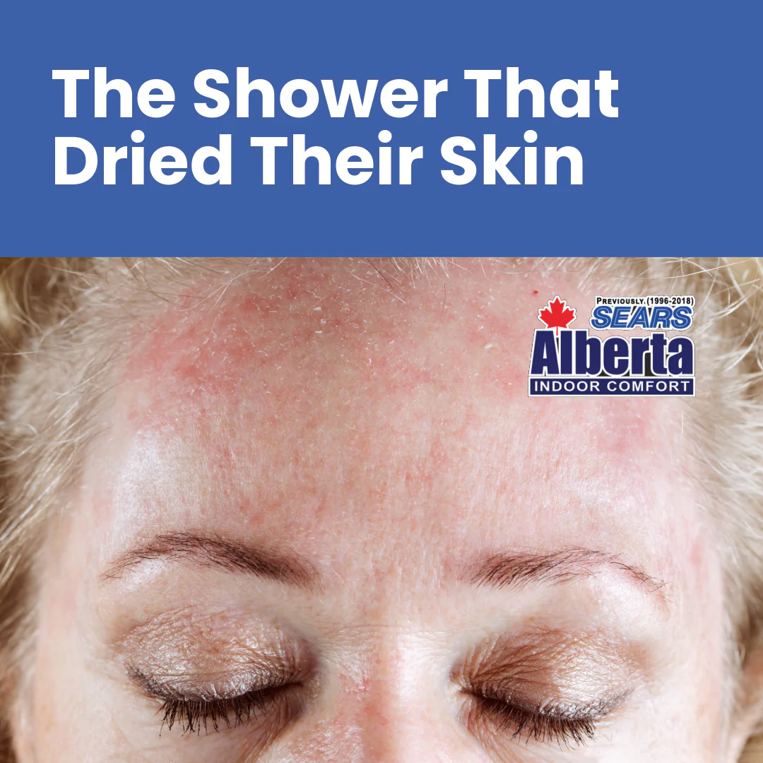 FBIG-WS Shower That Dried Their Skin